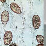 Chytridiomycota Overview