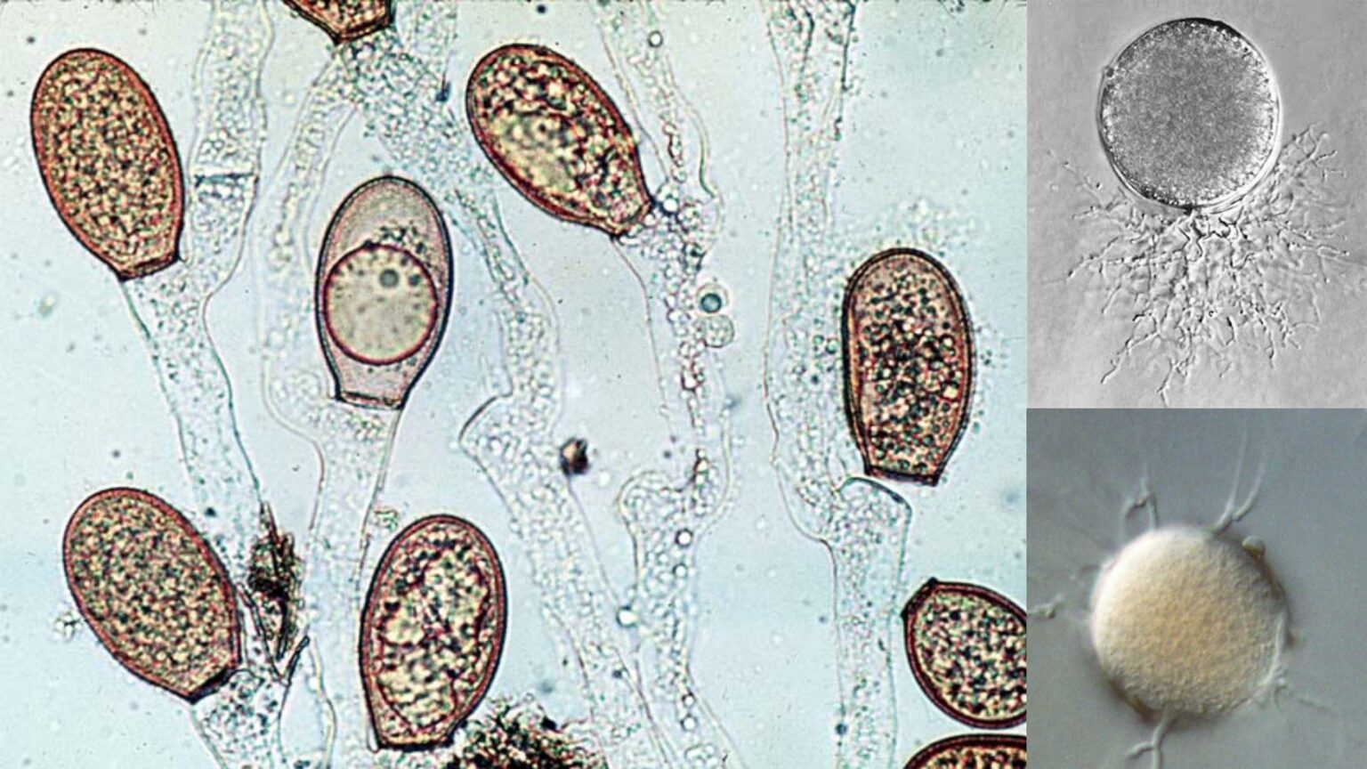 Candida parapsilosis - Morphology, Pathogenesis, Transmission