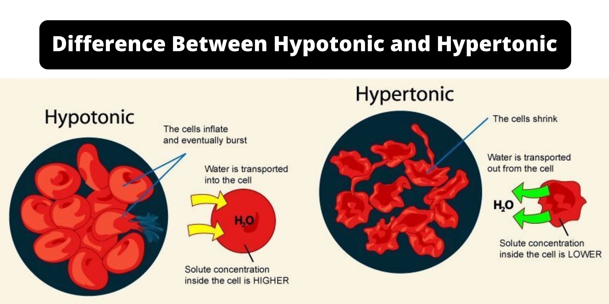 Difference Between Hypertonic vs Hypotonic