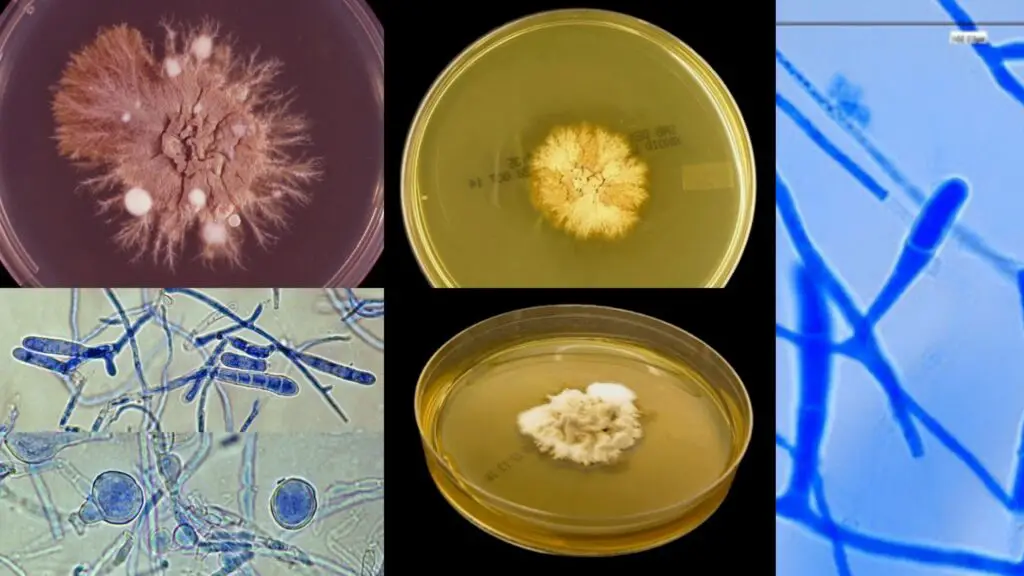 Epidermophyton floccosum - Biology Notes Online