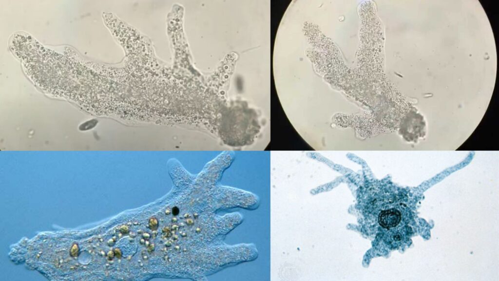 Amoeba Under A Microscope Amazing Amoeba Diversity Under The