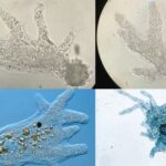 Amoeba - Fixing, Staining Techniques