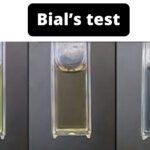 Bial test for pentoses Principle, Objective, Procedure, Result