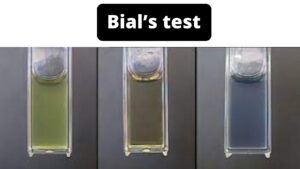 Bial test for pentoses Principle, Objective, Procedure, Result