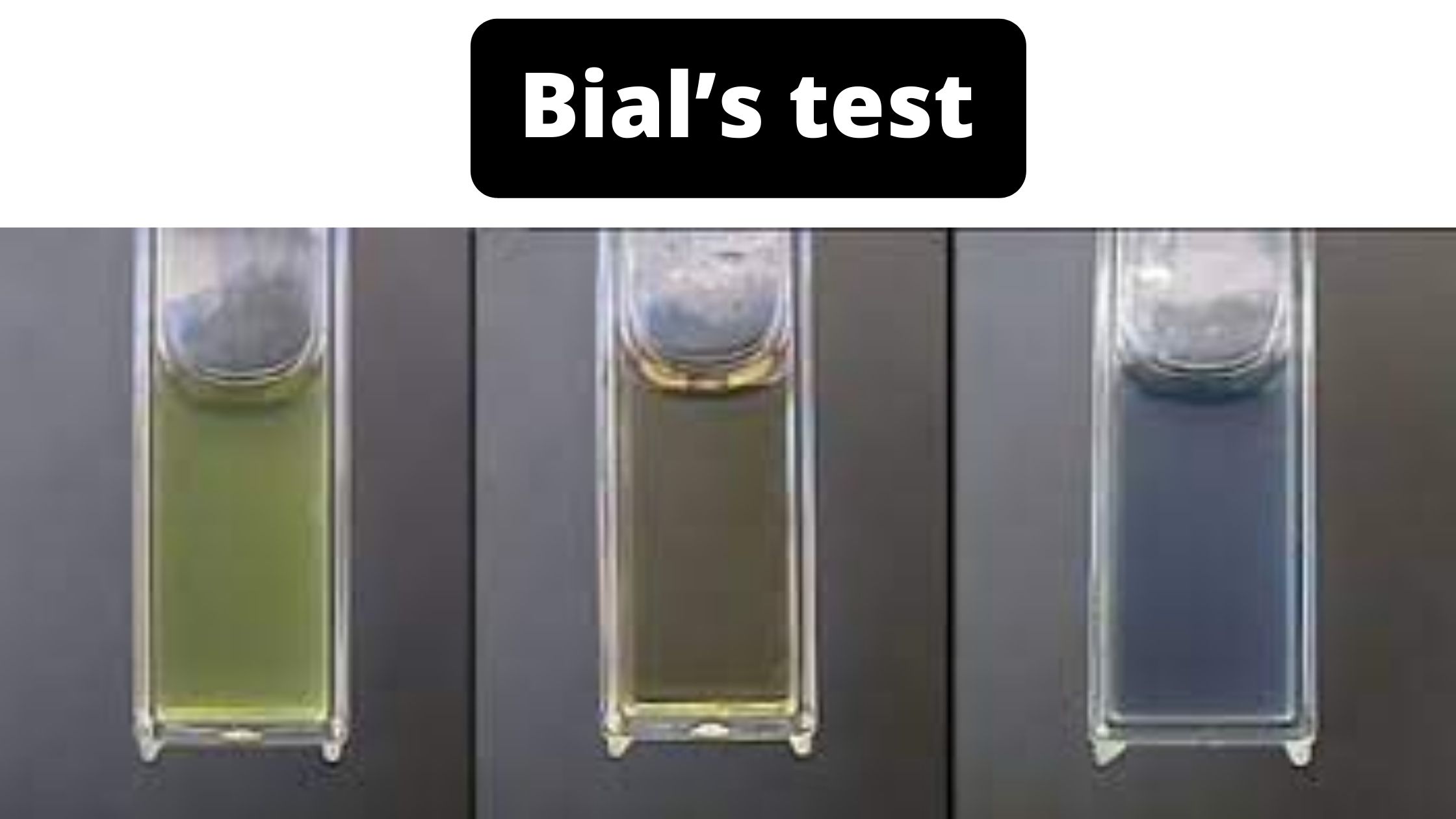 Bial test for pentoses Principle, Objective, Procedure, Result