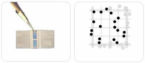 Hemocytometer and Haemocytometry