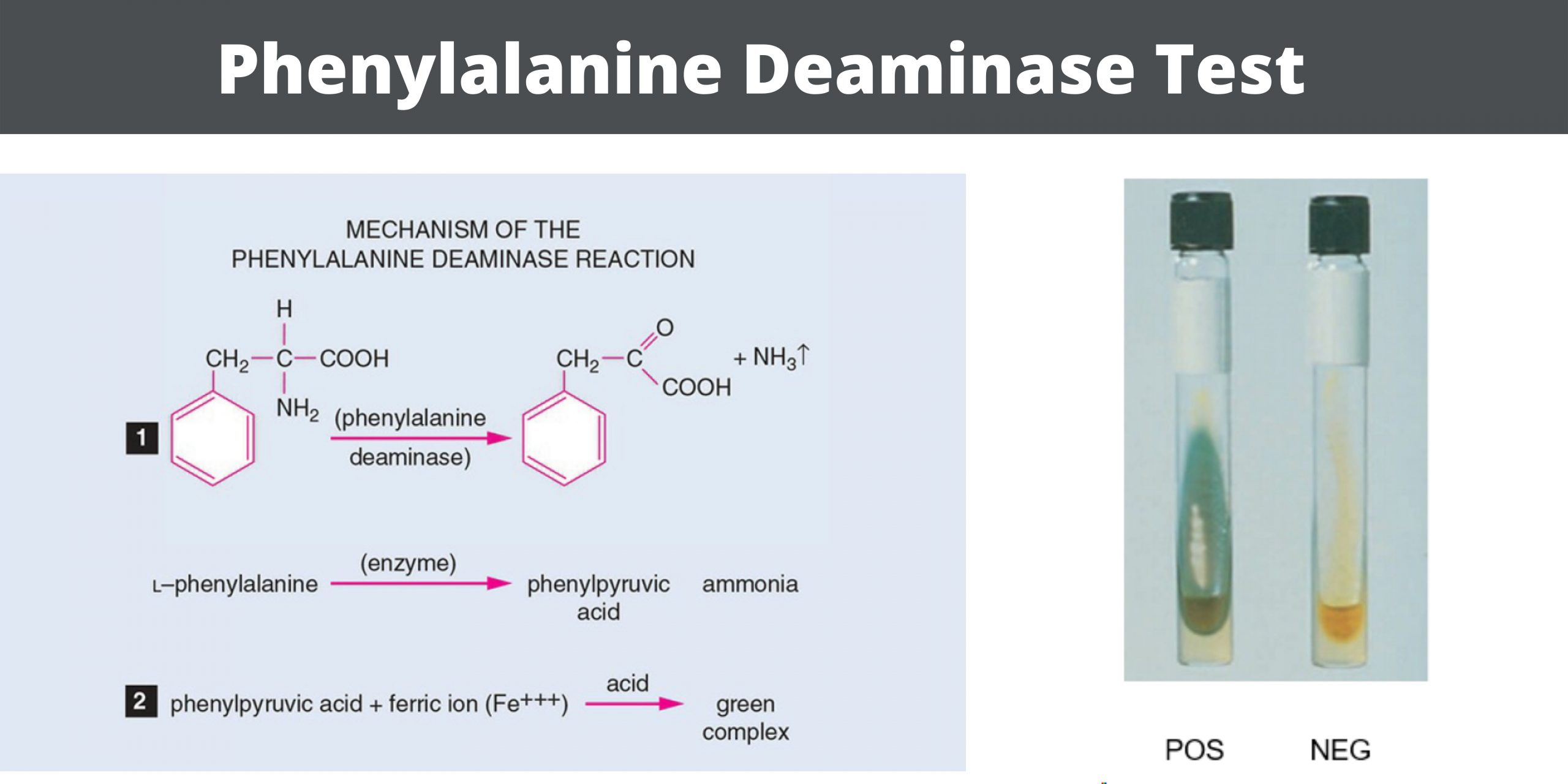 Phenylalanine Deaminase Test Principle, Procedure, Result