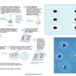 Radial Immunodiffusion Principle, Procedure, Result