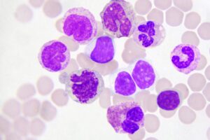 Total White Blood Cell (WBC) Count – Total Leucocyte Count (TLC)