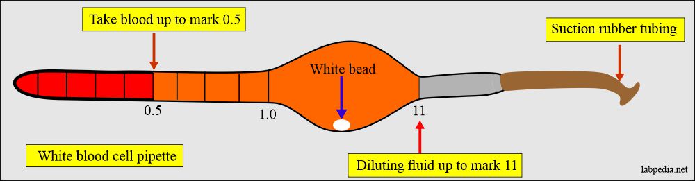 Total White Blood Cell (WBC) Count - Total Leucocyte Count (TLC)