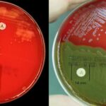 Bacitracin Susceptibility Test Principle, Procedure, Result