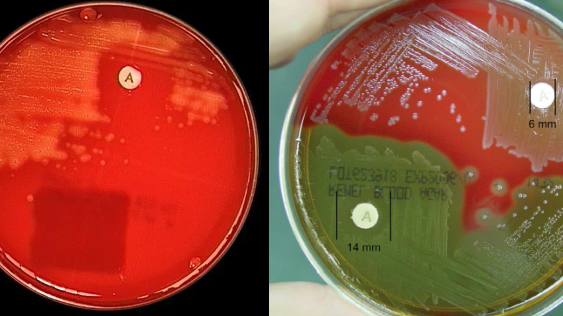 Bacitracin Susceptibility Test Principle, Procedure, Result