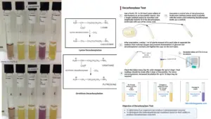 Decarboxylase Test – Principle, Procedure, Results, Uses