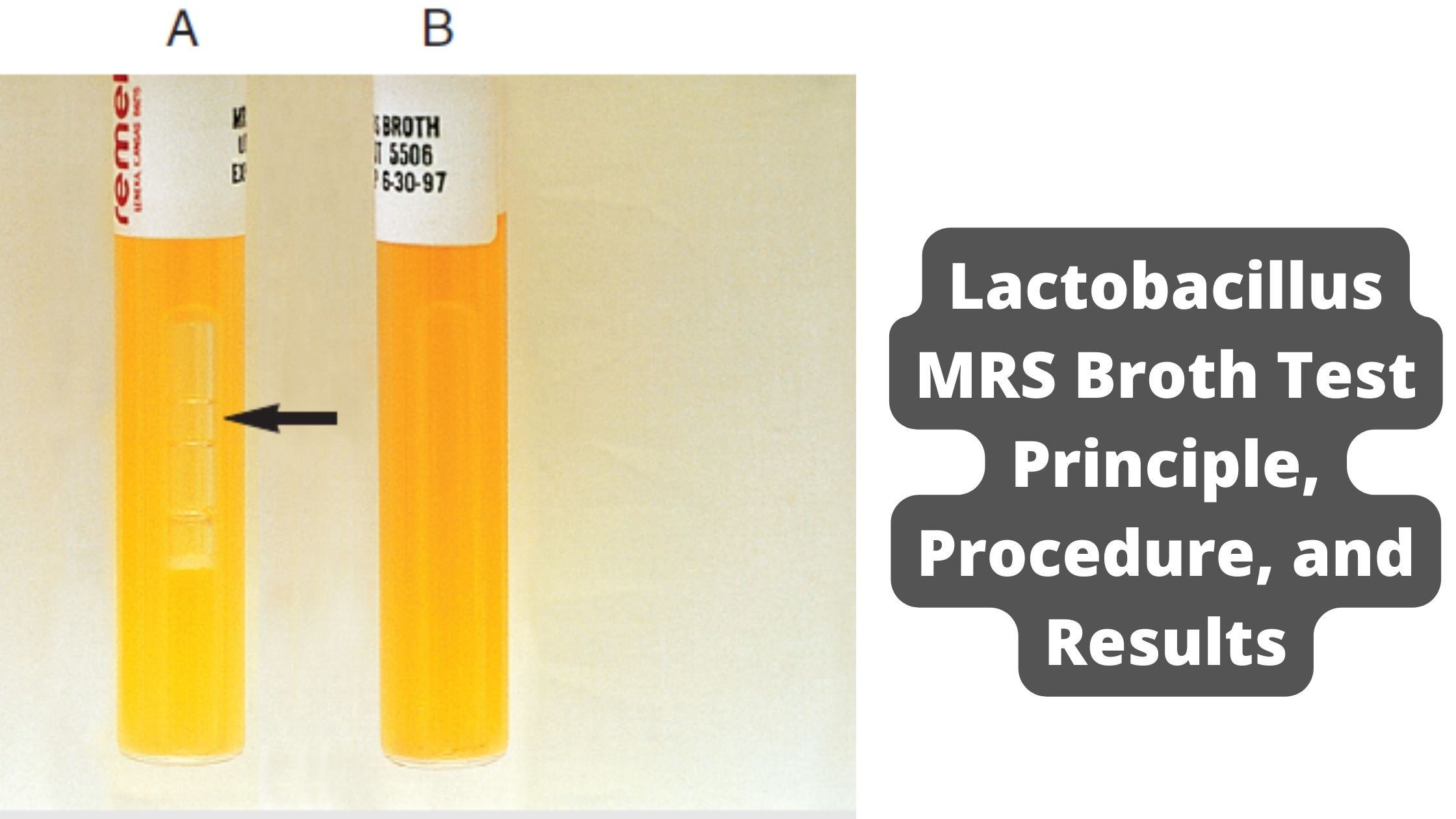 Lactobacillus MRS Broth Test - Principle, Procedure, and Results