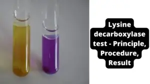Lysine decarboxylase test – Principle, Procedure, Result