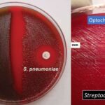 Optochin Susceptibility Test - Principle, Objective, Procedure And Results