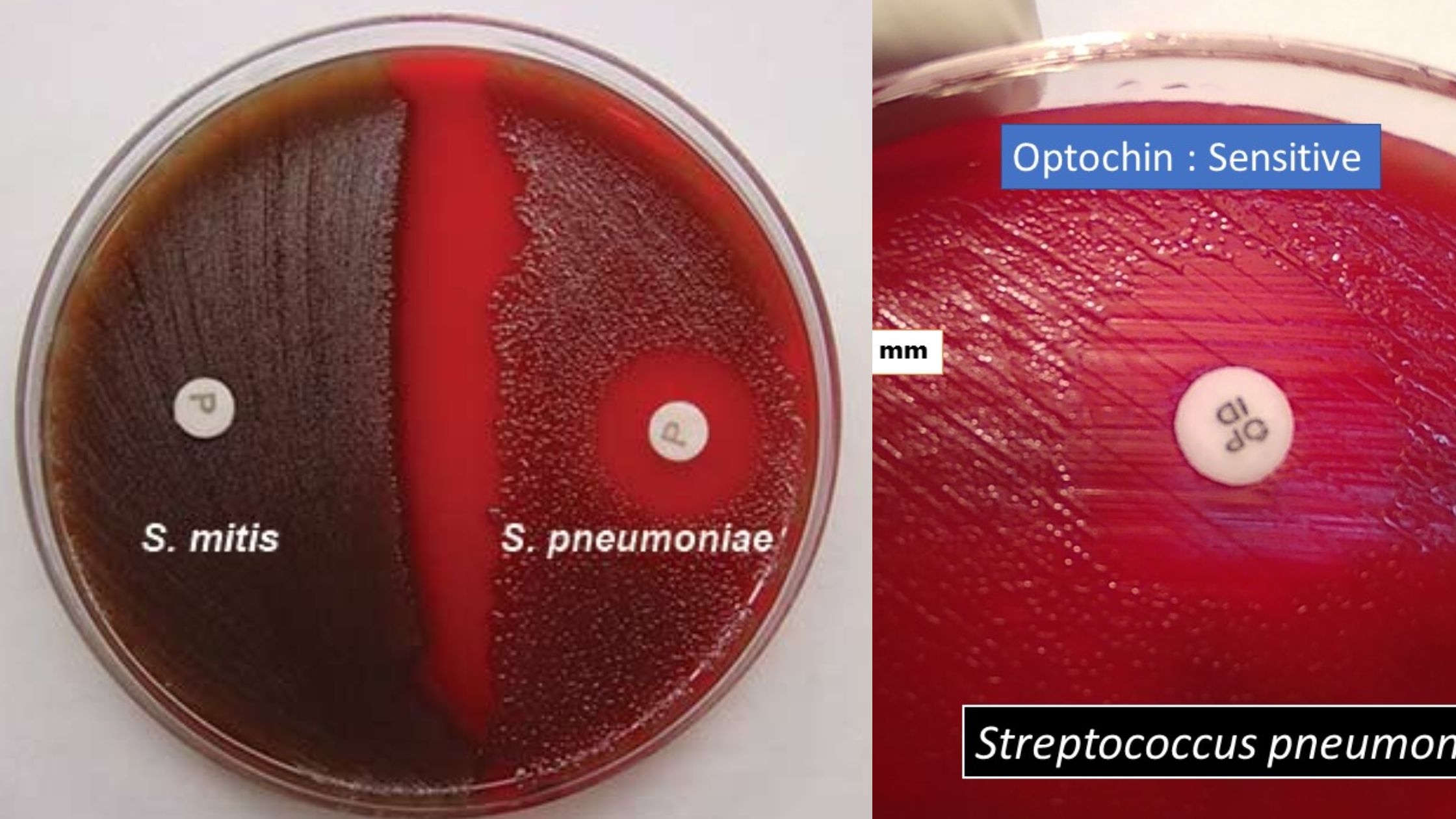 Optochin Susceptibility Test - Principle, Objective, Procedure And Results