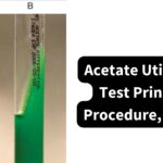 Acetate Utilization Test - Principle, Procedure, Results