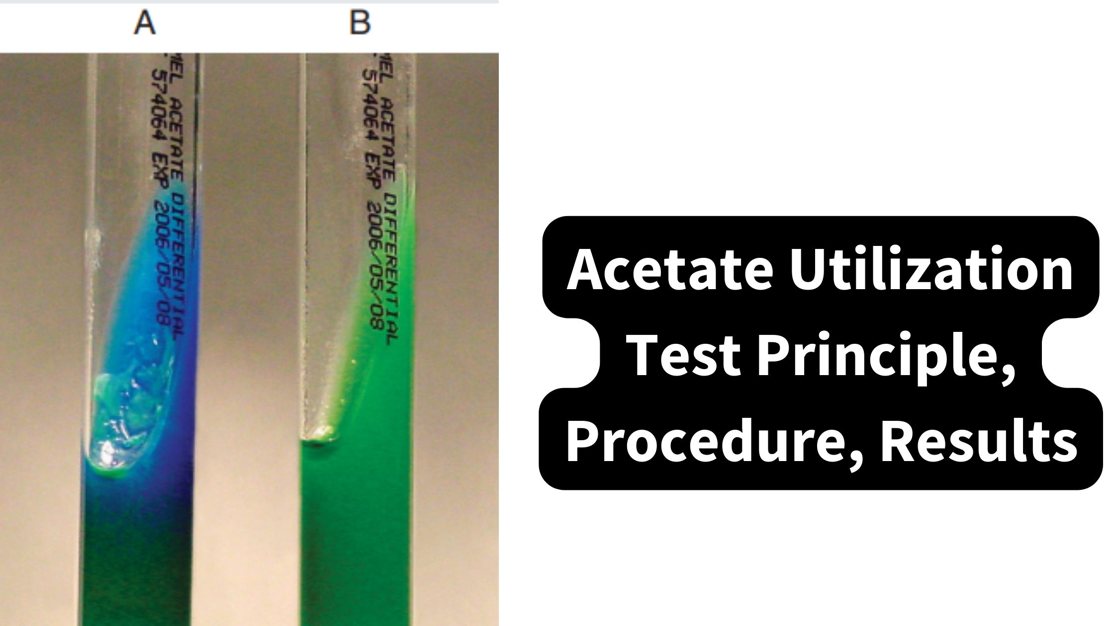 Acetate Utilization Test - Principle, Procedure, Results