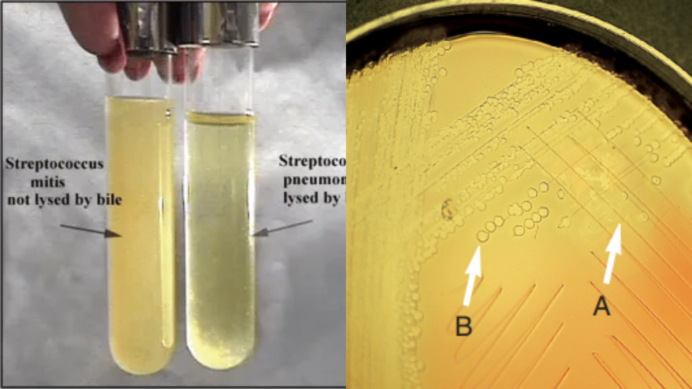 Bile Solubility Test - Principle, Procedure, Result