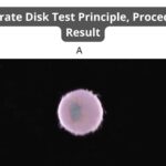 Butyrate Disk Test Principle, Procedure, Result