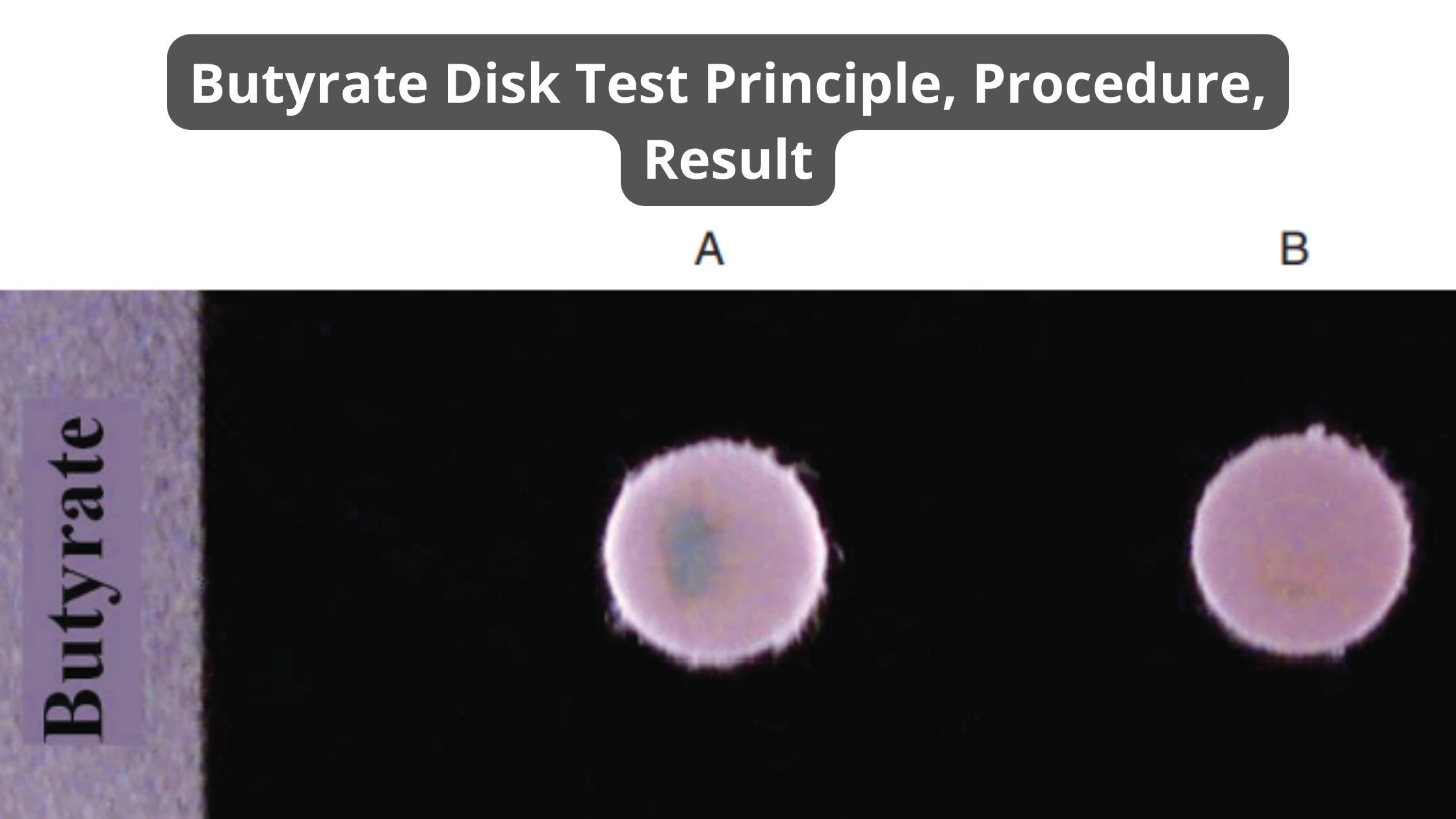 Butyrate Disk Test Principle, Procedure, Result