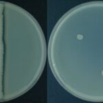 Casein Hydrolysis Test Principle, Procedure, Result