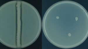 Casein Hydrolysis Test – Principle, Procedure, Result