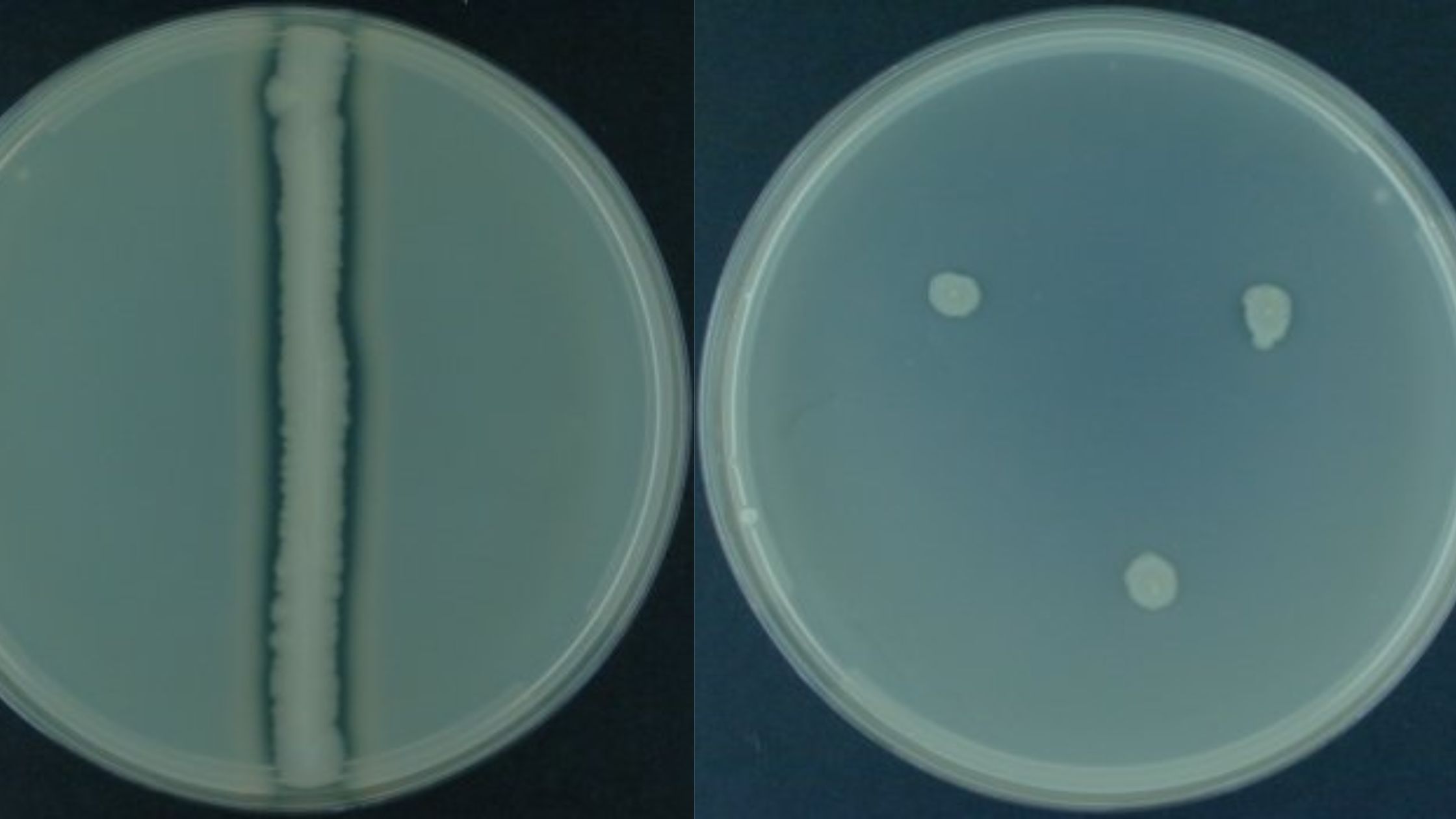 Casein Hydrolysis Test Principle, Procedure, Result