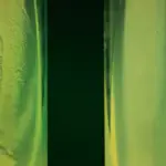 Cetrimide Test - Principle, Purpose, Procedure, Results