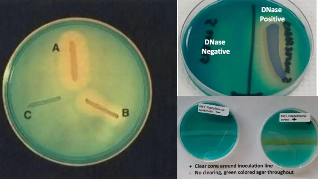 Deoxyribonuclease (DNase) Test - Principle, Procedure, Result - Biology ...