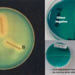 Deoxyribonuclease (DNase) Test Principle, Procedure, Result