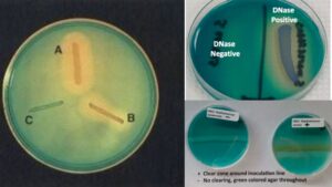 Deoxyribonuclease (DNase) Test – Principle, Procedure, Result