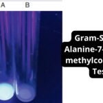 Gram-Sure (L-Alanine-7-amido-4-methylcourmarin) Test 