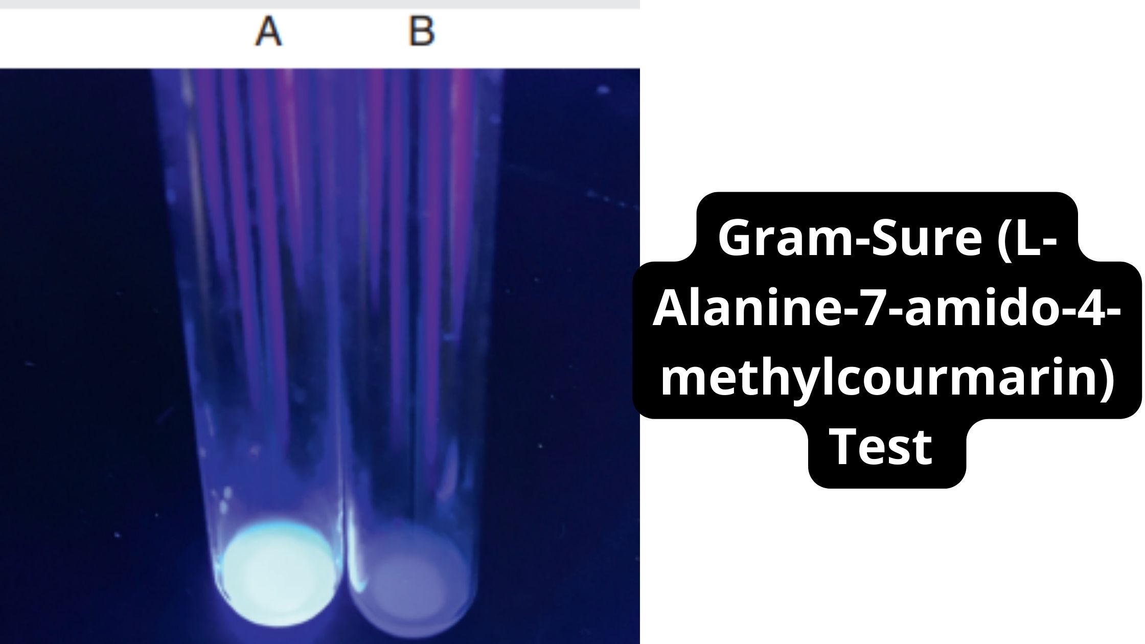 Gram-Sure (L-Alanine-7-amido-4-methylcourmarin) Test 