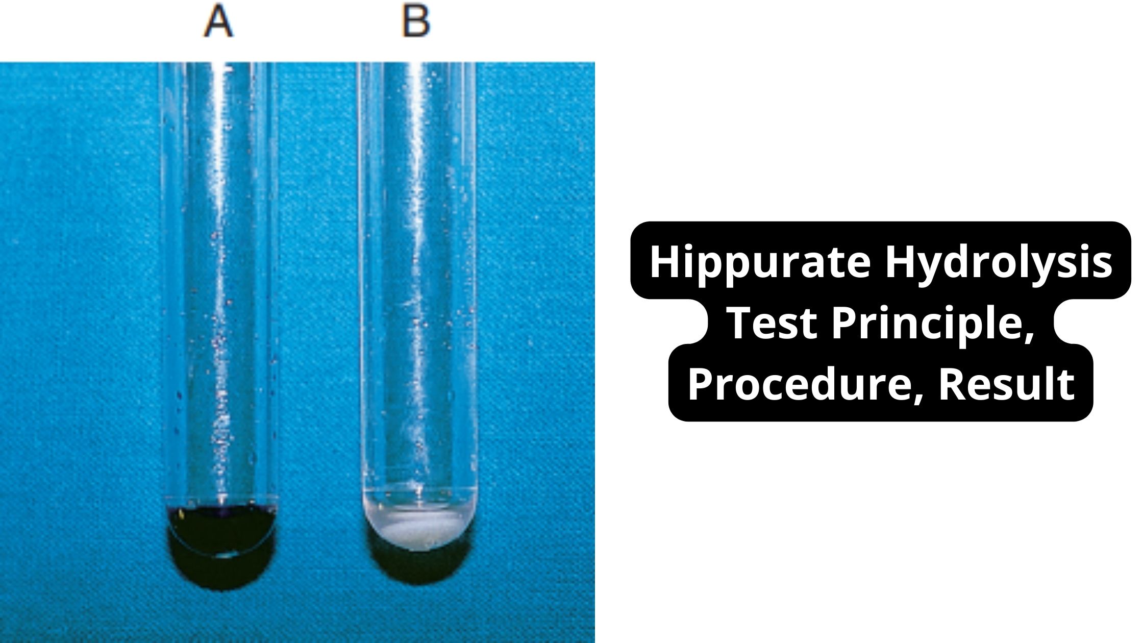 Hippurate Hydrolysis Test Principle, Procedure, Result