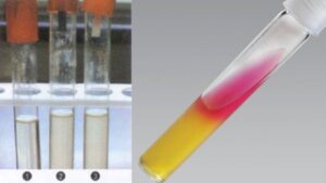 Hydrogen Sulfide (H2S) Test – Principle, Procedure, Result