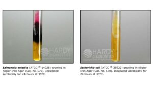 Kligler’s Iron Agar Test – Principle, Procedure, Result