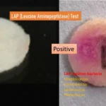 Leucine aminopeptidase (LAP) Test Principle, Procedure, Results