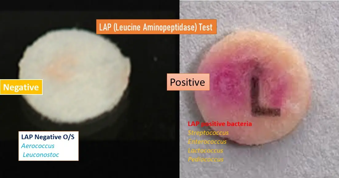 Leucine aminopeptidase (LAP) Test Principle, Procedure, Results