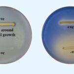 Lipase Test Principle, Procedure, results