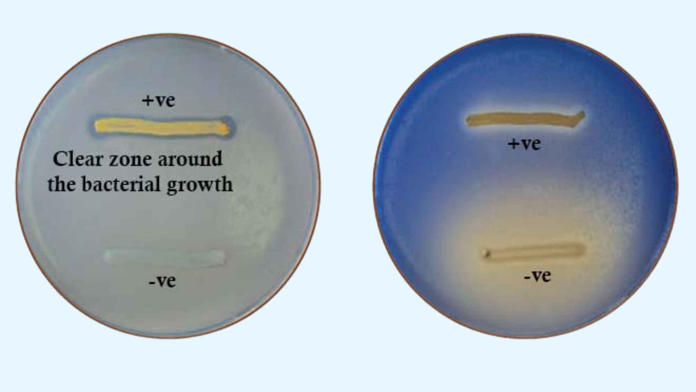 Lipase Test Principle, Procedure, results