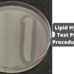Lipid Hydrolysis Test Principle, Procedure, Result