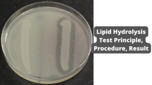 Lipid Hydrolysis Test – Principle, Procedure, Result