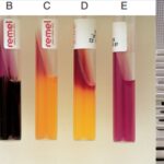 Lysine Iron Agar (LIA) Test Principle, Procedure, Result