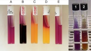 Lysine Iron Agar (LIA) Test Principle, Procedure, Result