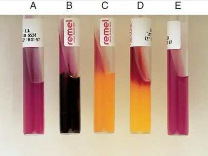 Result of Iron Agar test Procedure