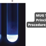 4-Methylumbelliferyl-β-D-Glucuronide (MUG) Test Principle, Procedure, Results