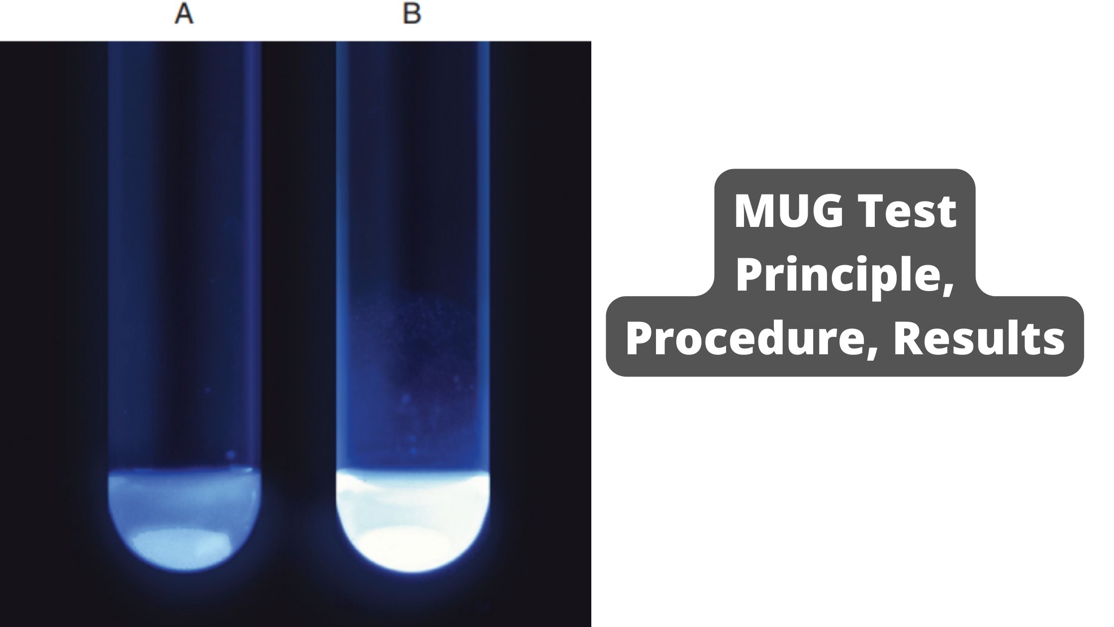 4-Methylumbelliferyl-β-D-Glucuronide (MUG) Test Principle, Procedure, Results