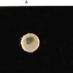 Microdase Test Principle, Procedure, Result